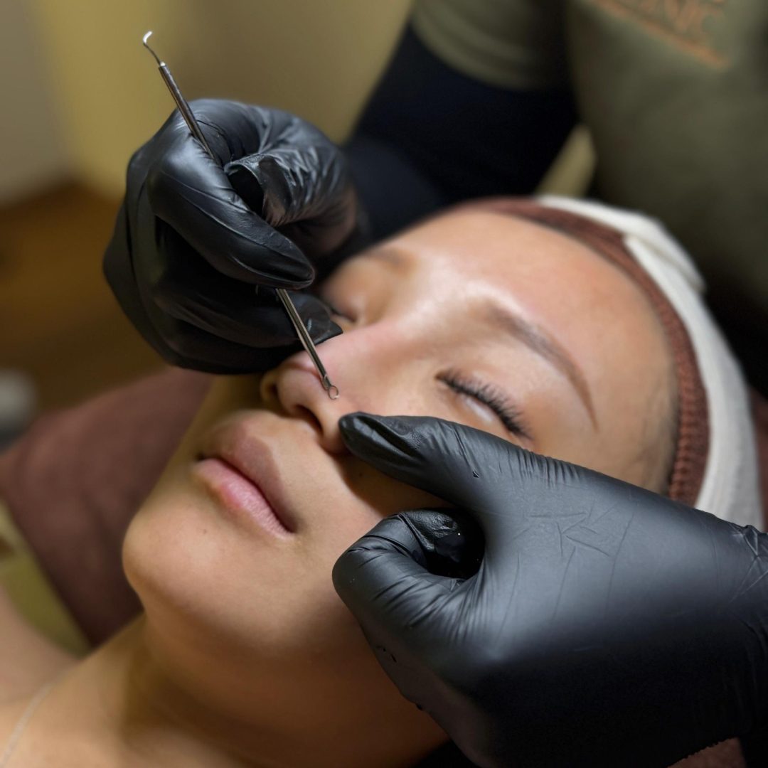 Exfoliation & deep pore cleansing