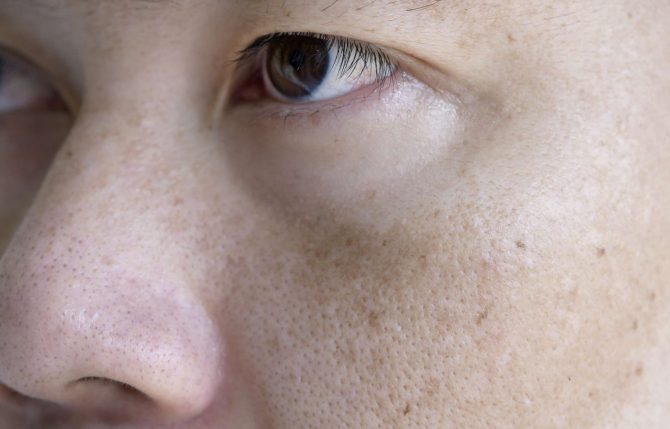 close-up-asian-man-face-with-freckles-dark-spots-f-2024-12-22-23-18-26-utc-min