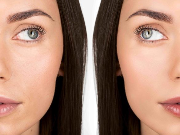 face-of-attractive-young-woman-before-and-after-re-2024-11-18-21-24-58-utc-min